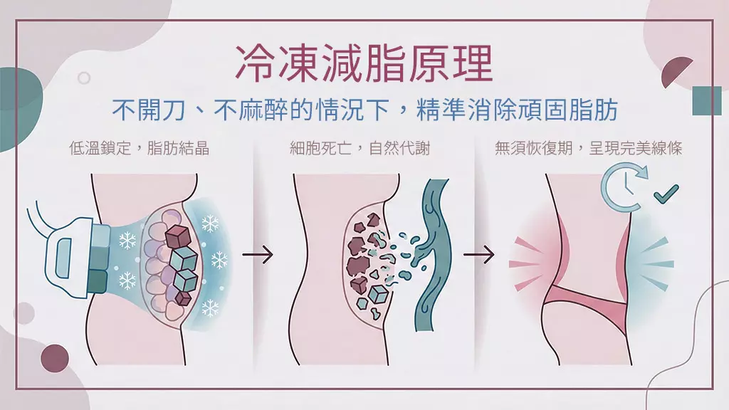 冷凍減脂的運作原理