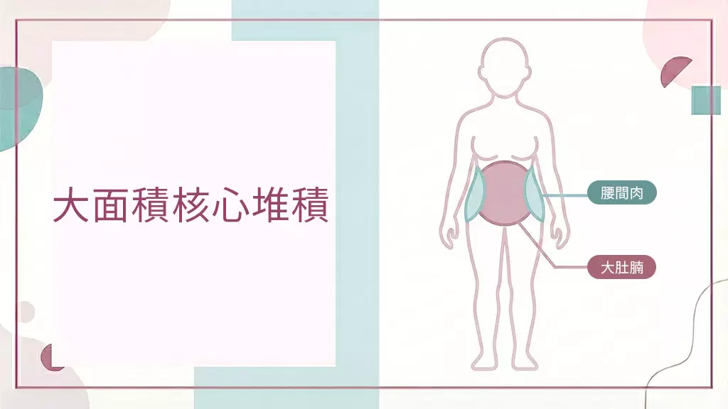 大面積核心堆積