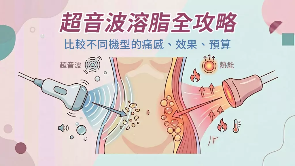 不需動刀也能瘦！超音波溶脂全攻略：不同機型的痛感、效果、預算一次比較