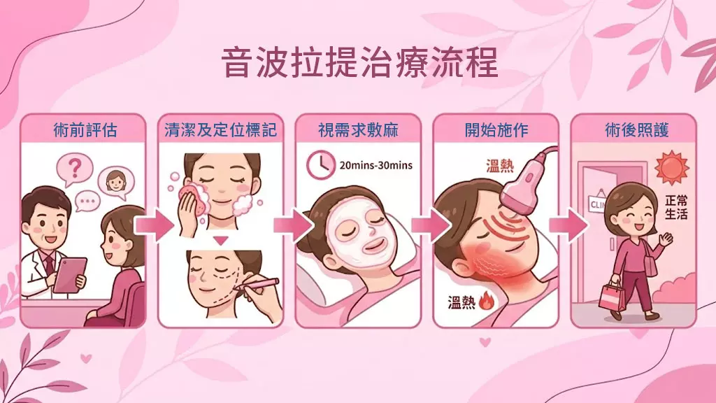 音波拉提治療流程