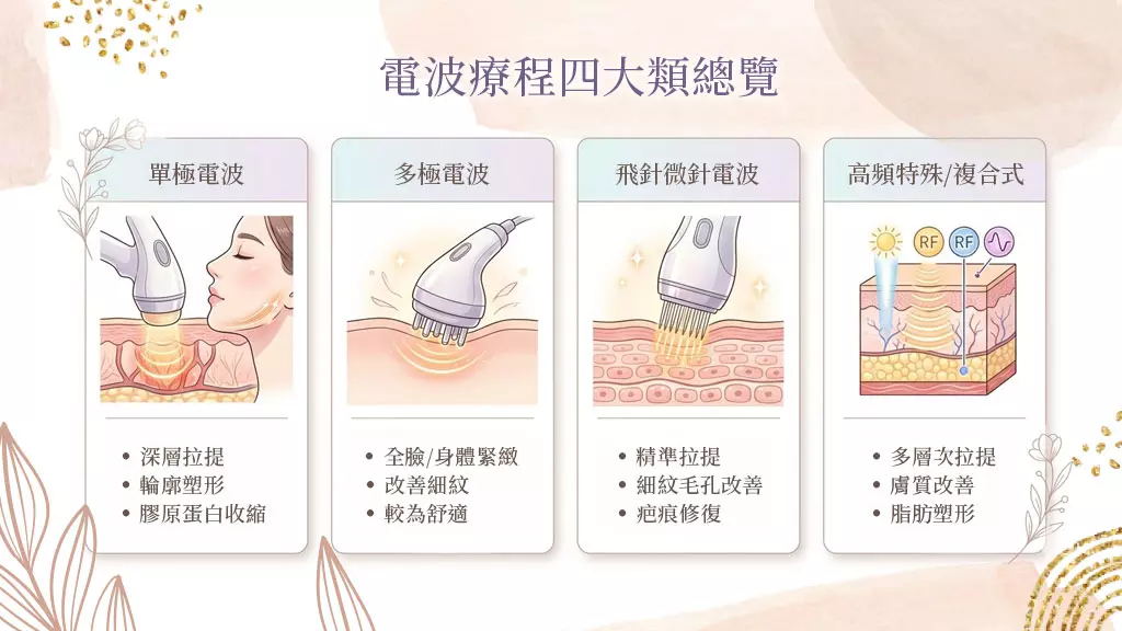 電波療程四大種類總覽