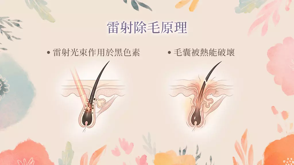 雷射原理